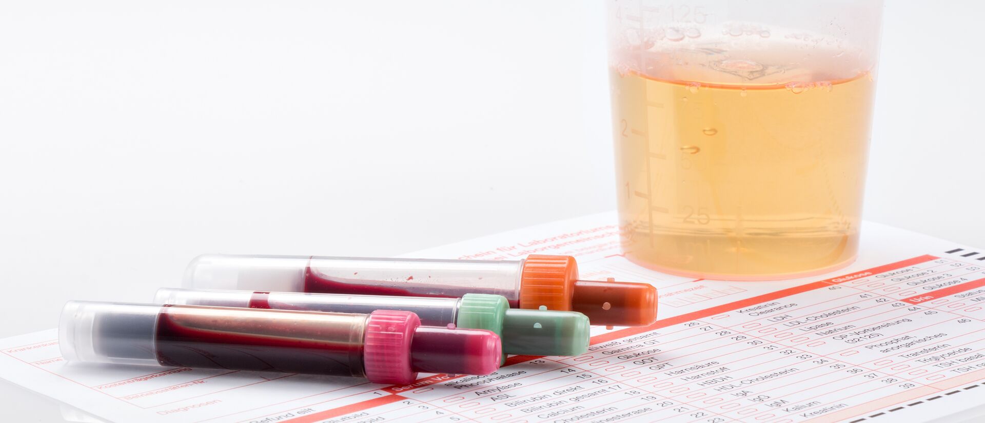Labor Krankenhaus Spremberg - Laboratoriumsmedizin